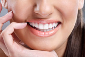 All-on-4 Dental Implants