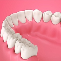 Gum Disease Warren, OH