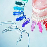 Invisalign vs Traditional Braces
