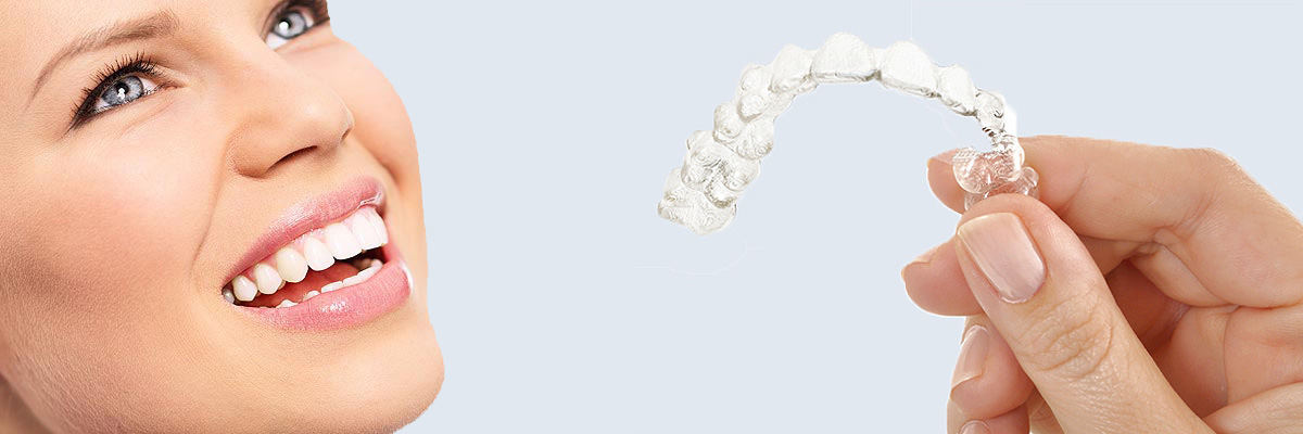 Warren 7 Things Parents Need to Know About Invisalign Teen