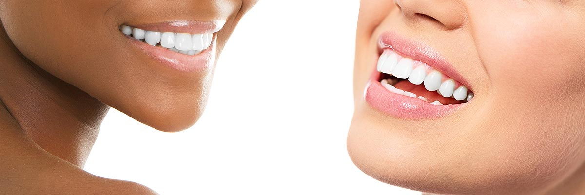 Warren Teeth Whitening