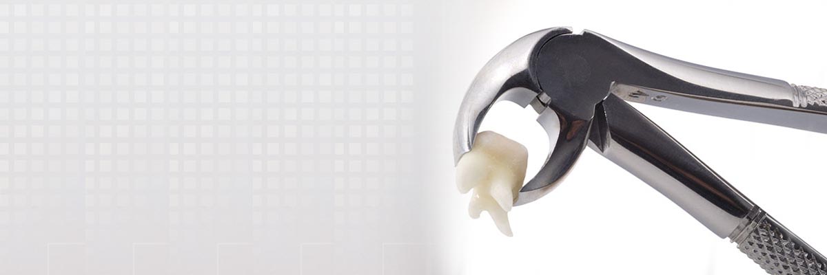 Warren Tooth Extraction